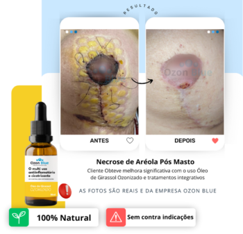 Óleo de Girassol Ozonizado2